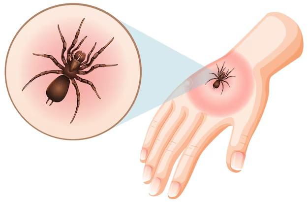 Are Basement Spiders Dangerous?